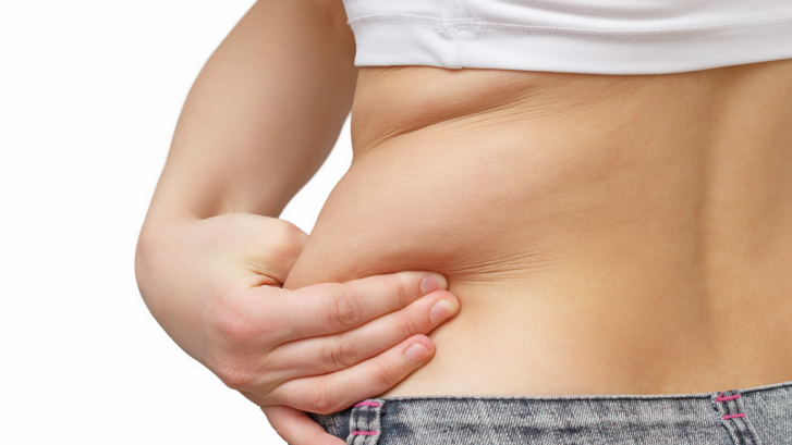La Plata MD Liposuction Results